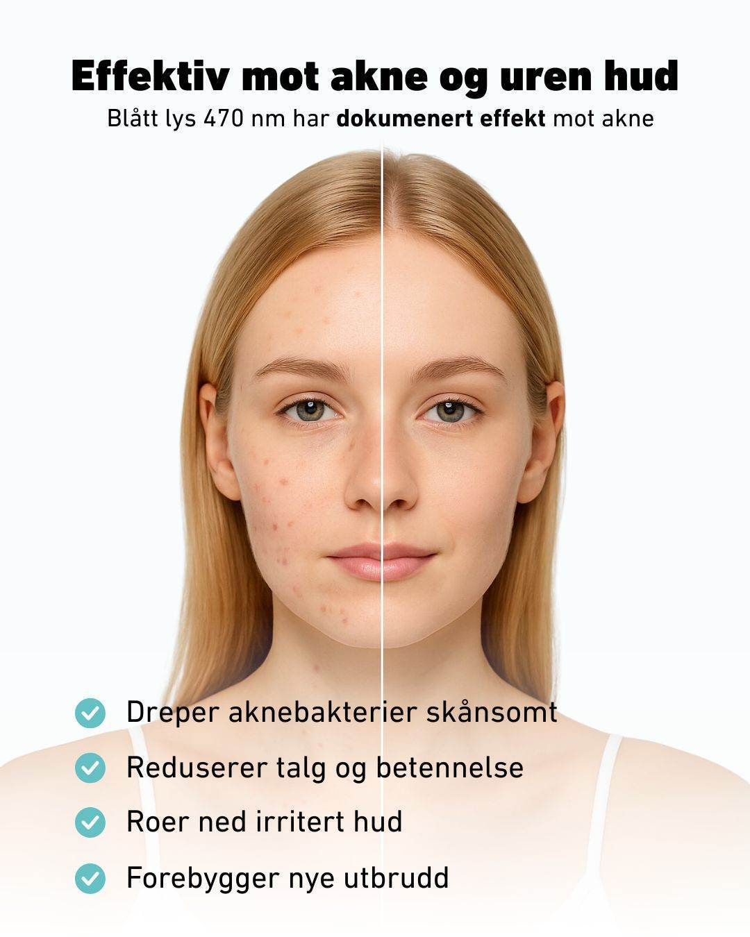 LED - lysmaske til ansikt mot akne, rynker og pigmentflekker - Lindas Dekor