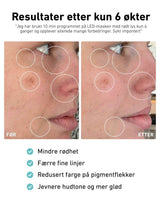 LED-lysmaske til ansikt mot akne, rynker og pigmentflekker