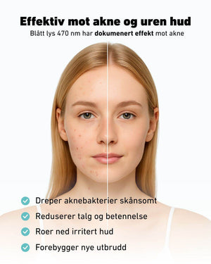 LED - lysmaske til ansikt mot akne, rynker og pigmentflekker - Lindas Dekor